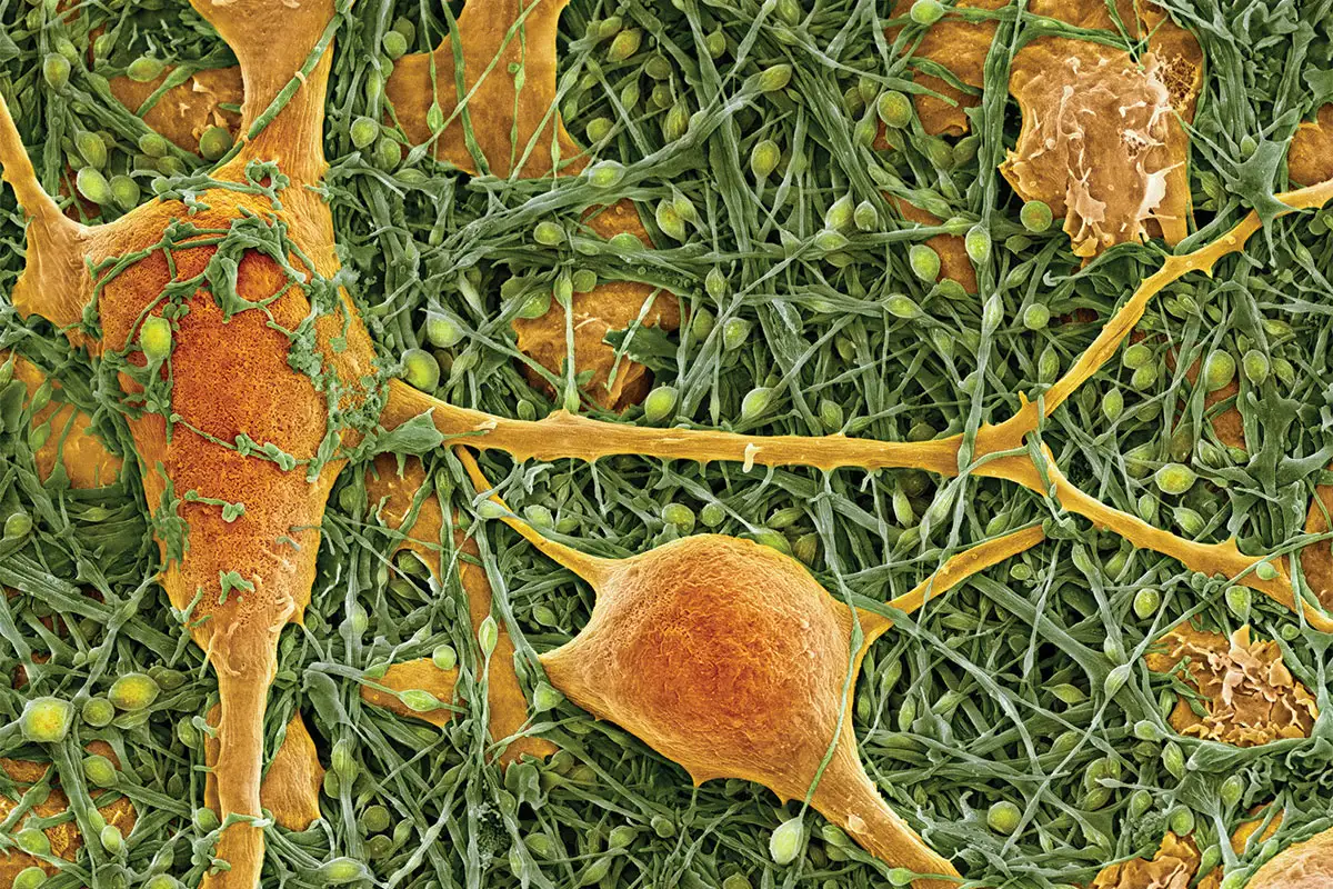 nerve cells and glial cells sem spl